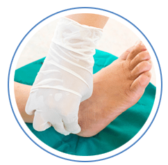 Surgical Correction of Foot Problems in Lansing, IL 60438 & Chicago, IL 60617
