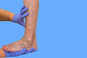 How Does a Podiatrist Assess Vascular Disease?