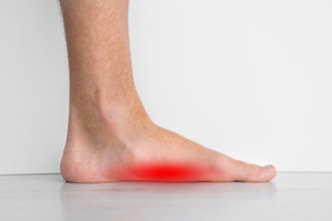 Dealing with Acquired Flat Foot