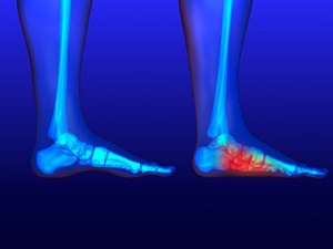 Are My Feet Flat?