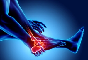 Causes of Sever’s Disease