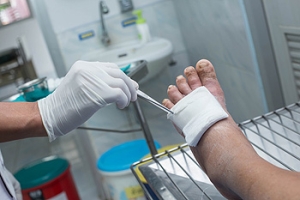 Diabetes and Daily Foot Checks