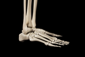 Diagnosis of Stress Fractures